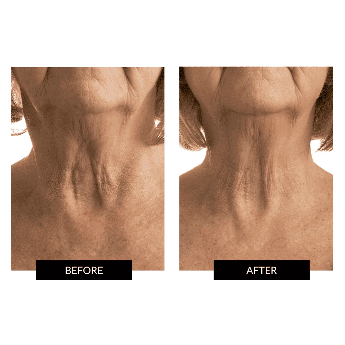 RETURNS - CurrentBody Skin Face & Neck Kit - Image 10