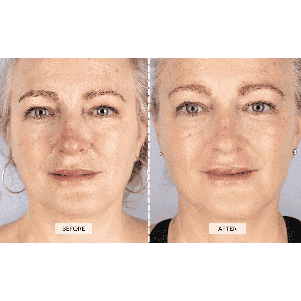 RETURNS - CurrentBody Skin Face & Neck Kit - Image 7