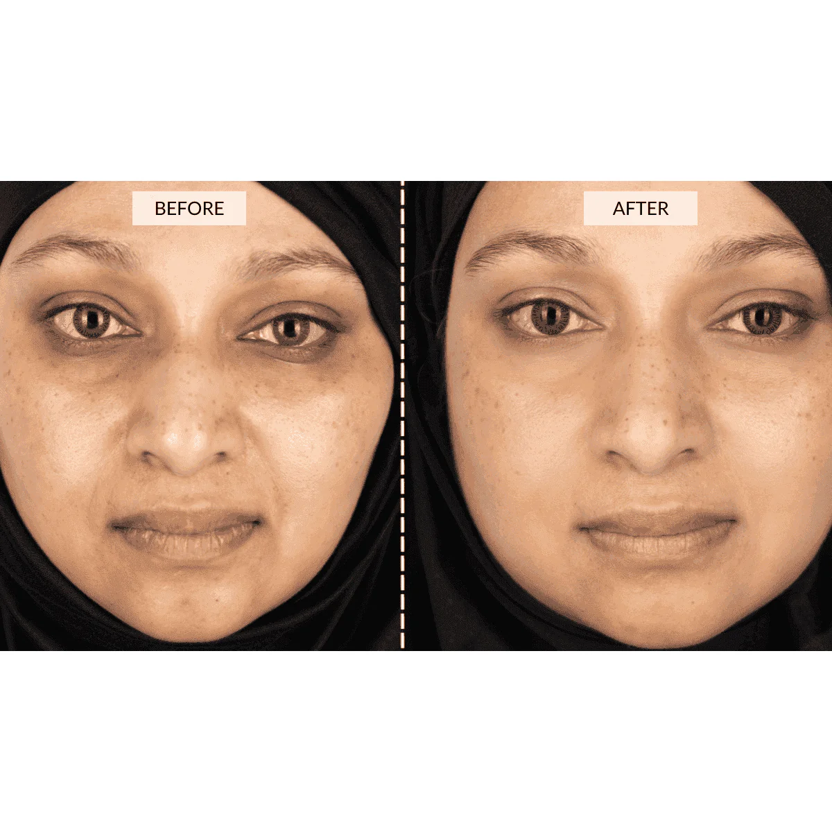 RETURNS - CurrentBody Skin Face & Neck Kit - Image 8